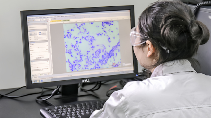 Biocatalysis Screening